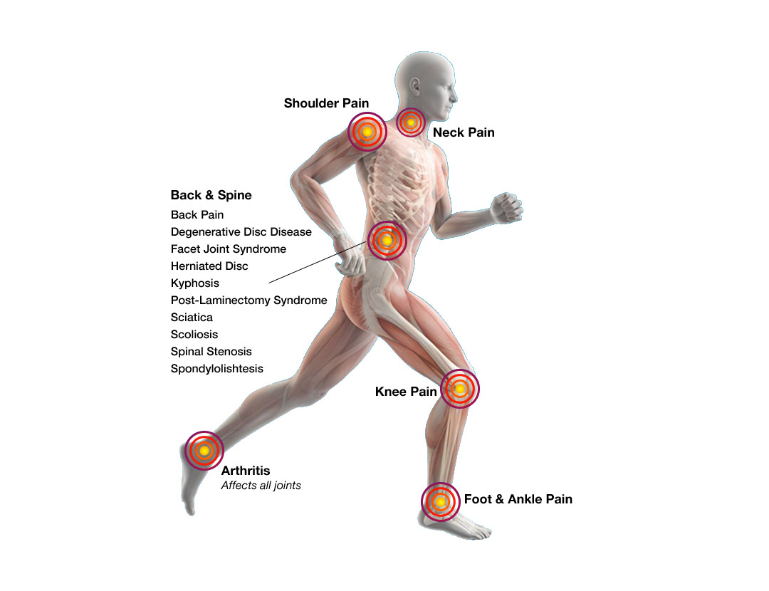 Sample Pain Body