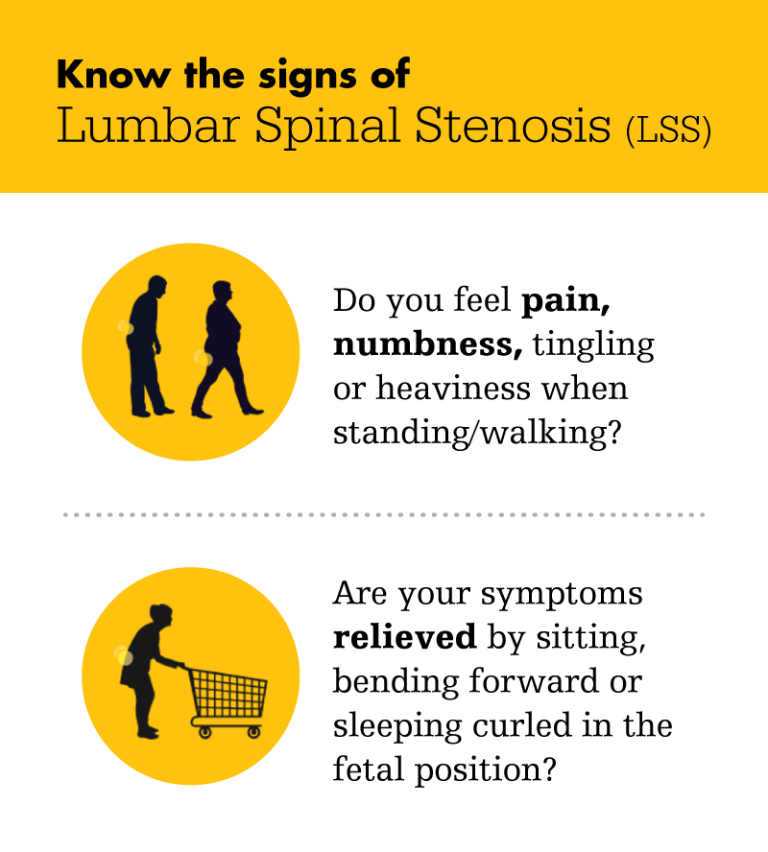 Lumbar Spinal Stenosis (LSS) - Pain Institute of Southern Arizona